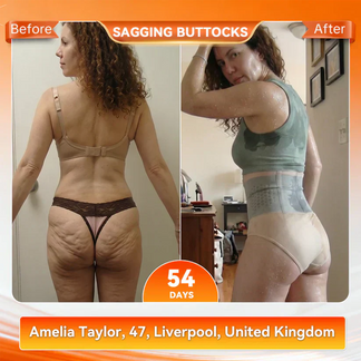 4-in-1 Thermo Sculpt Shorts – Sweat, Shape & Smooth Your Curves Instantly-EV